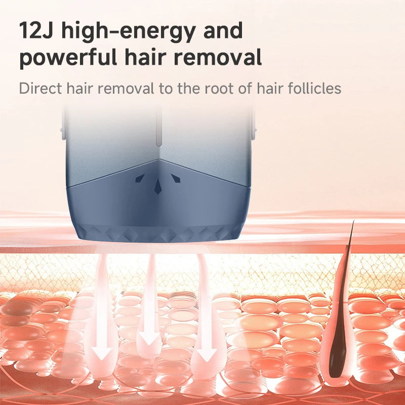Laser Hair Removal Device Ice Cooling Home Use Painless Hair Remover