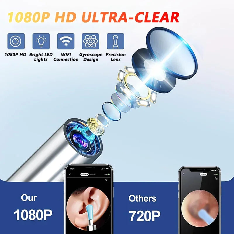 Ear Wax Removal Tool with Camera – HD Visual Ear Cleaner Endoscope for Safe Ear Cleaning