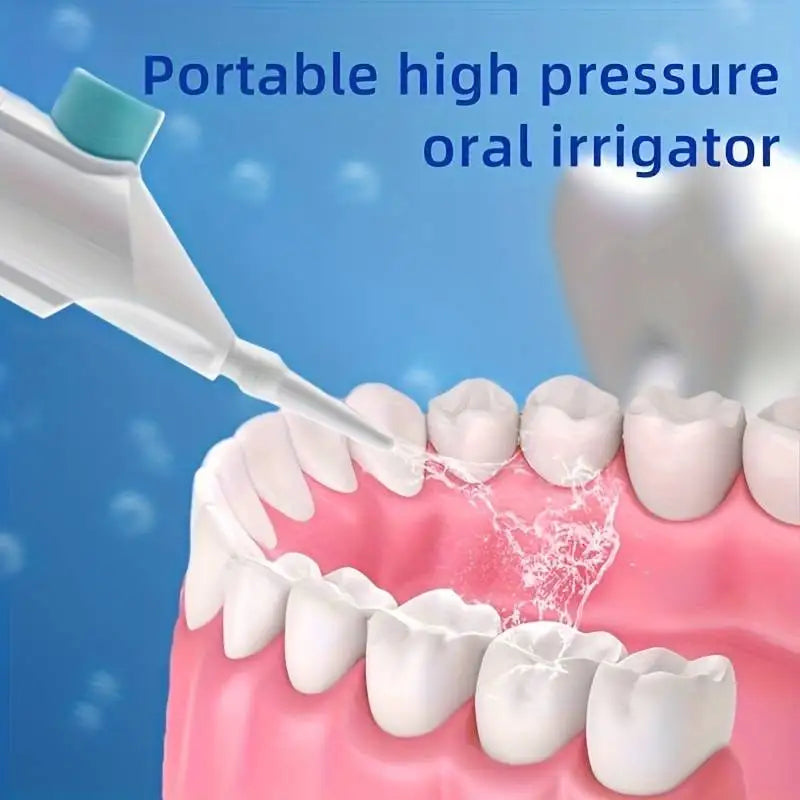 Portable Oral Irrigator – High Pressure Dental Water Flosser for Teeth Cleaning